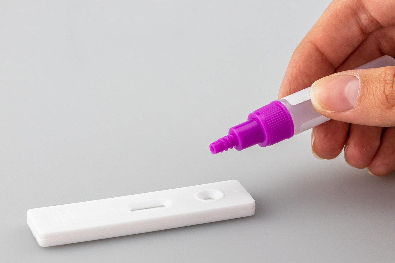 antigenovy test